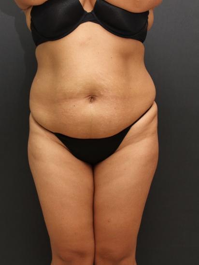 Main Photo Gallery, Case 6862, Before Treatment 