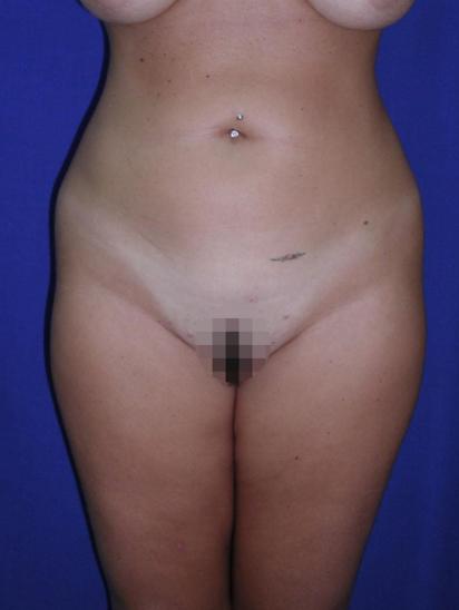 Main Photo Gallery, Case 6863, Before Treatment 