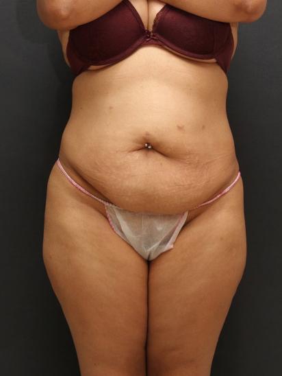 Main Photo Gallery, Case 6865, Before Treatment 