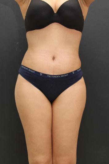 Main Photo Gallery, Case 6867, After Treatment