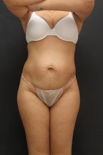Main Photo Gallery, Case 6867, Before Treatment 