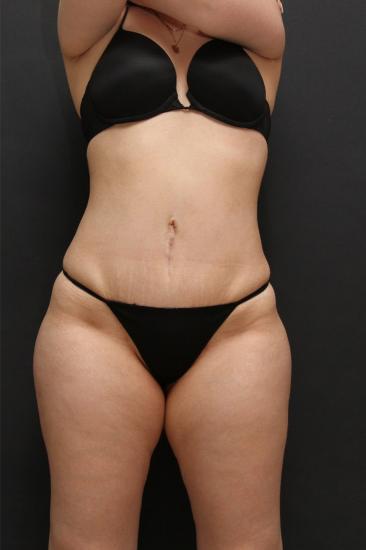 Main Photo Gallery, Case 6868, After Treatment