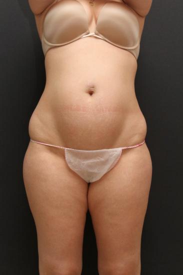 Main Photo Gallery, Case 6868, Before Treatment 