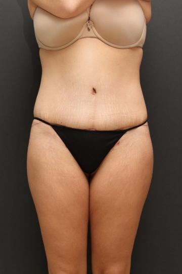 Main Photo Gallery, Case 6870, After Treatment