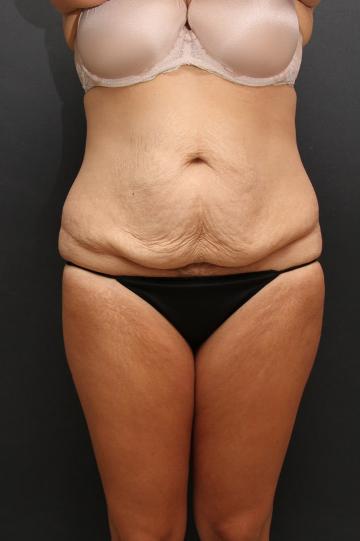 Main Photo Gallery, Case 6870, Before Treatment 