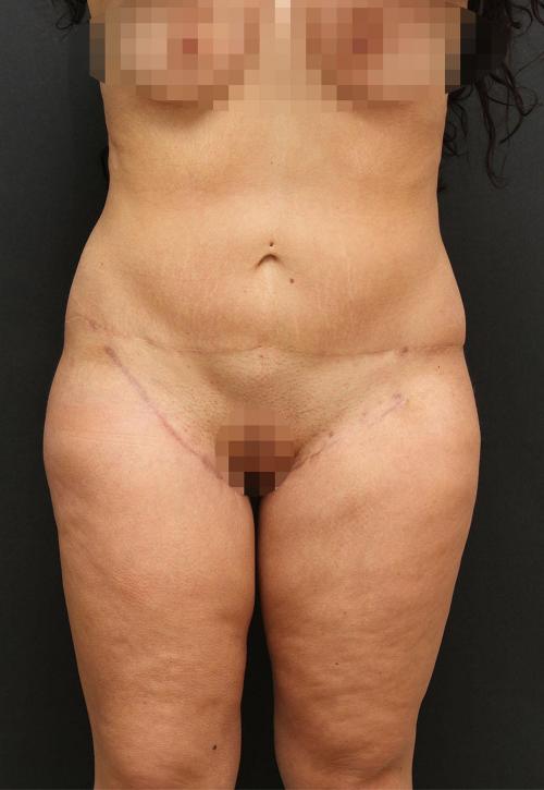 Main Photo Gallery, Case 6872, After Treatment