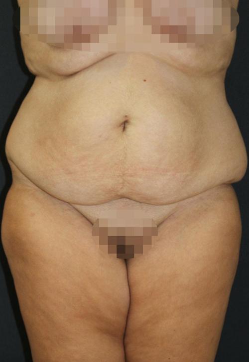 Main Photo Gallery, Case 6872, Before Treatment 