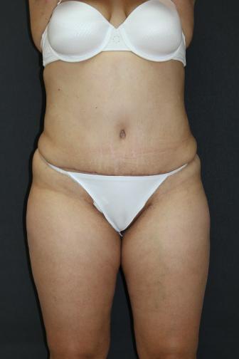 Main Photo Gallery, Case 6875, After Treatment