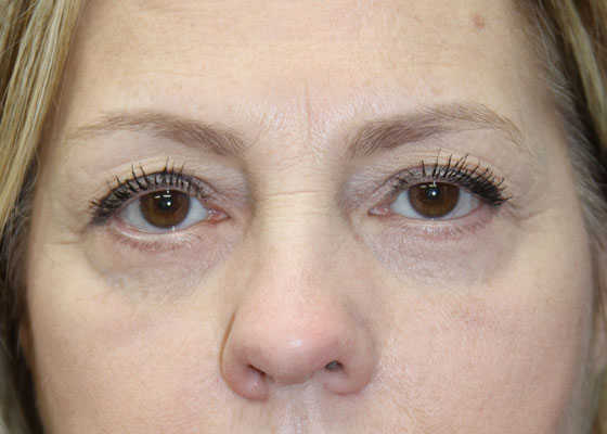 Main Photo Gallery, Case 6733, After Treatment