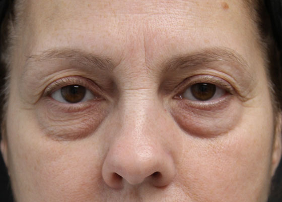 Main Photo Gallery, Case 6733, Before Treatment 