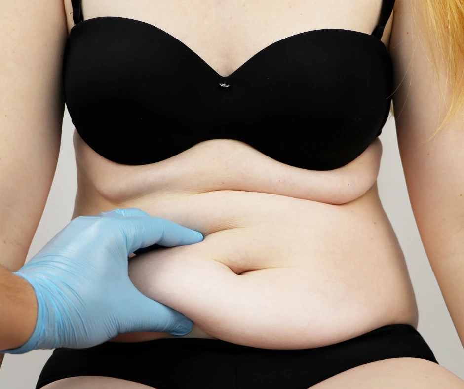 Surgeon Evaluating Abdominal Area of Woman During Mommy Makeover Consultation